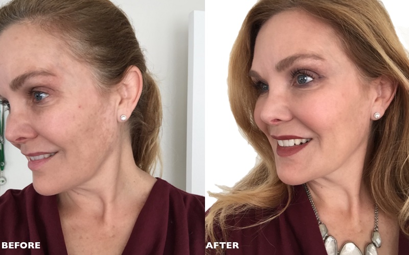 It cosmetics dramatic before and after photos | roundandroundrosie.com 